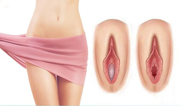 راههای تشخيص پارگی بكارت